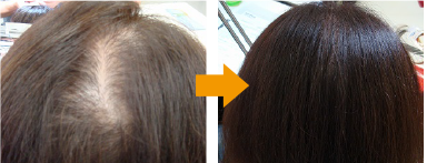 40代女性｜600本増毛